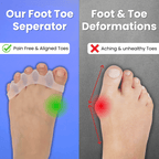 Strivon Toe Align – Foot Toe Separator for Bunions & Hammer Toes